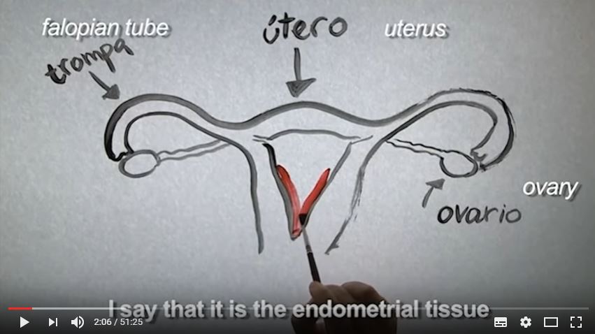 endometriosis documental
